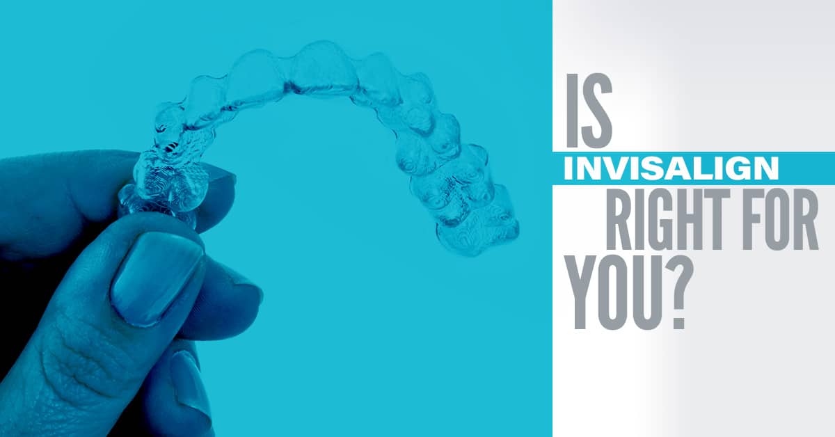 Invisalign Seattle