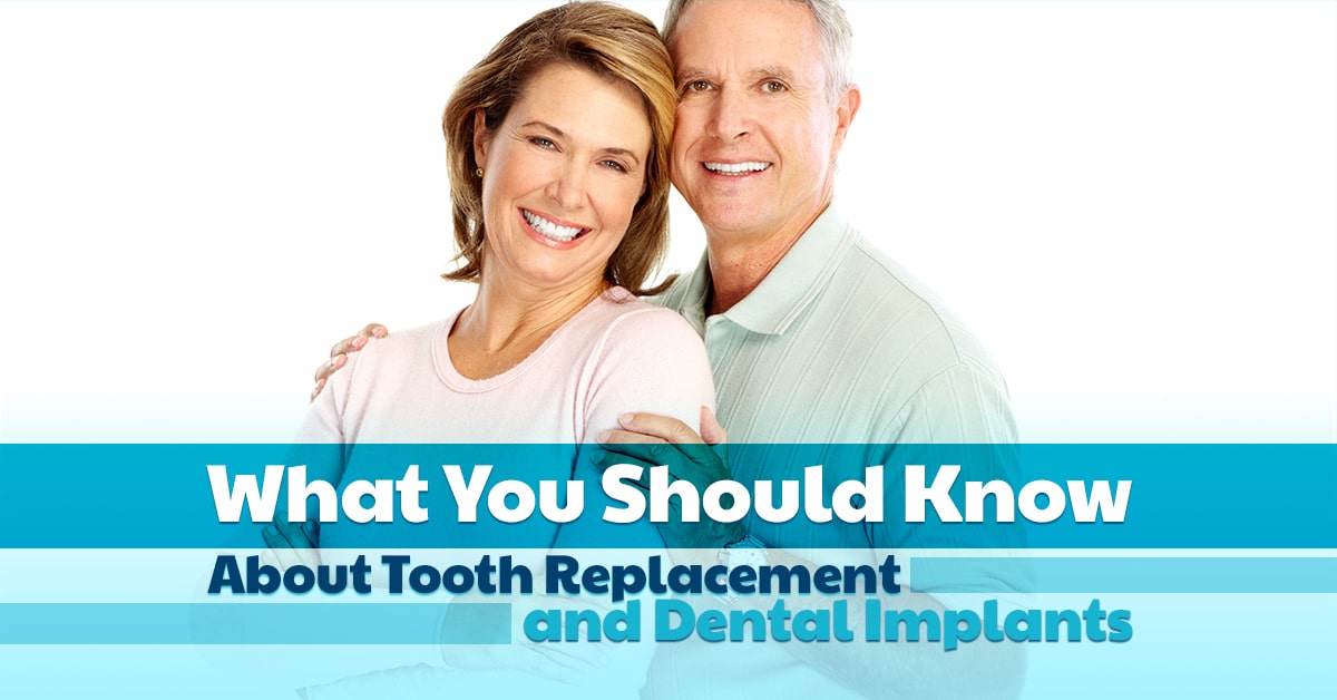 Smiling middle-aged couple with text about tooth replacement and dental implants information.