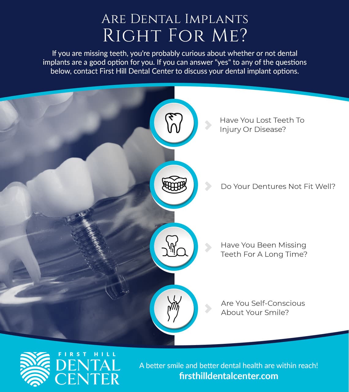 Are Dental Implants Right For Me?