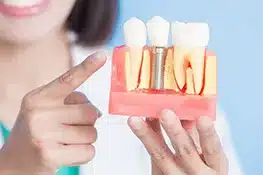 Woman holding dental implant model against blue background, pointing at tooth structure display.