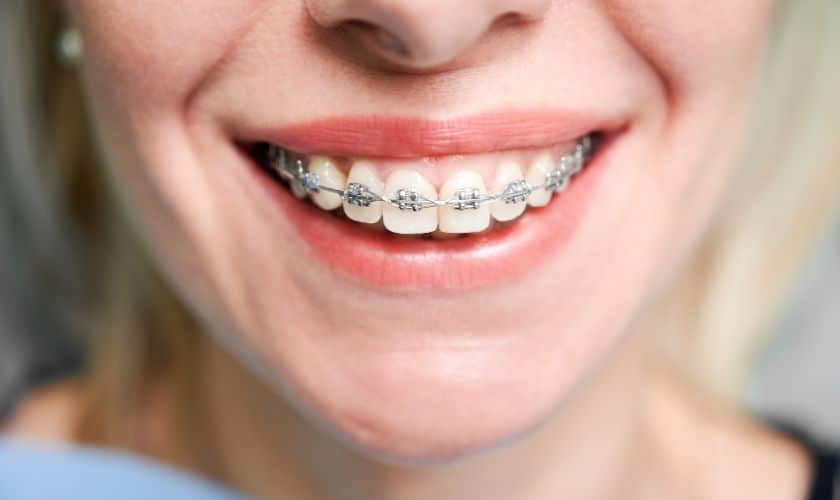 Orthodontist Seattle WA