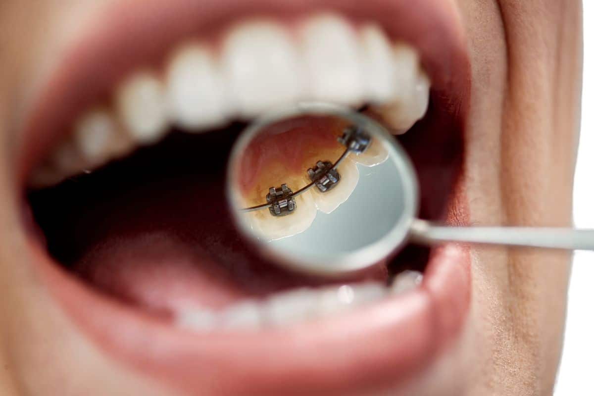 Orthodontist in Seattle