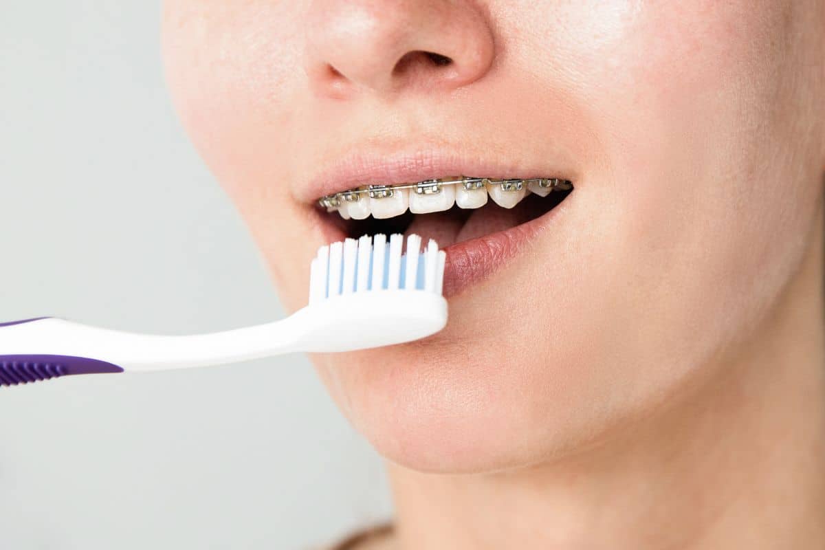 Orthodontist Seattle