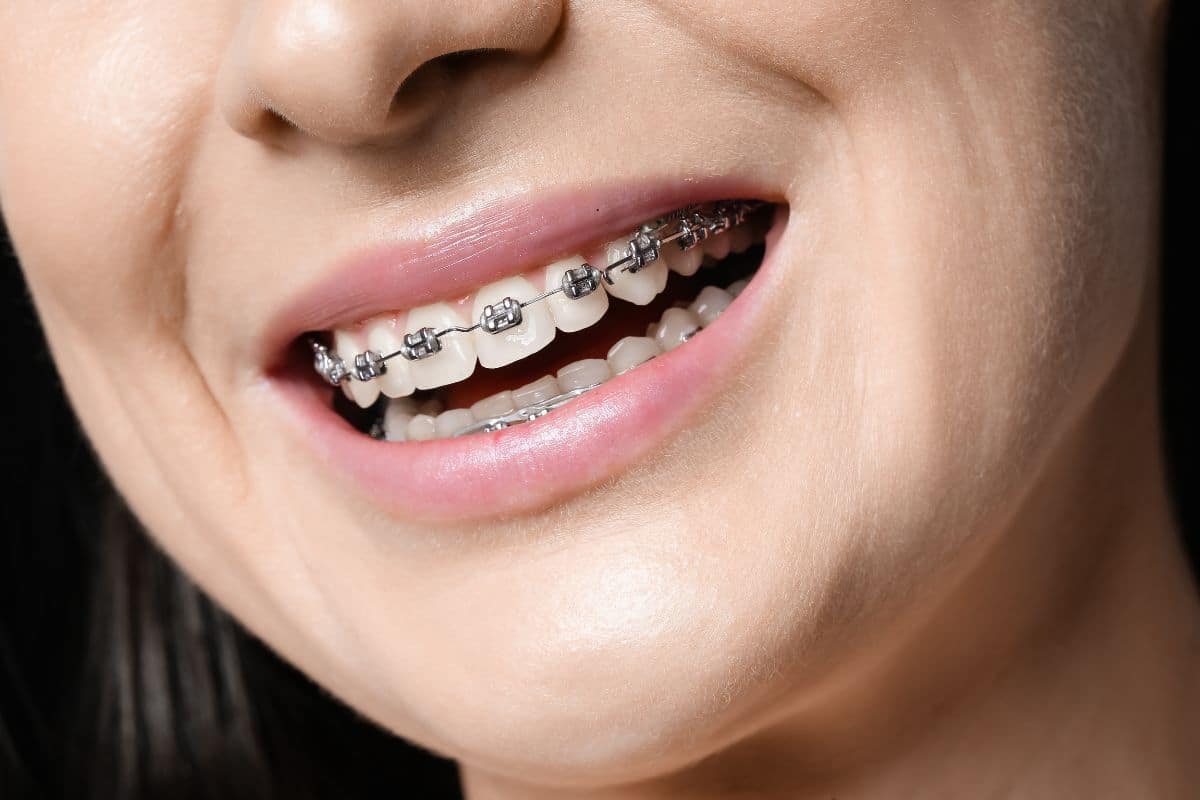 Orthodontist in Seattle