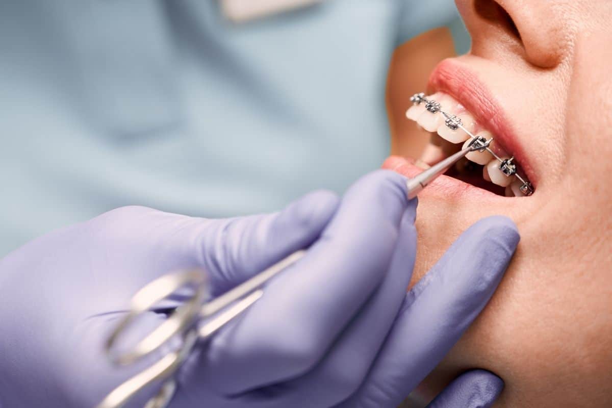 Orthodontist in Seattle