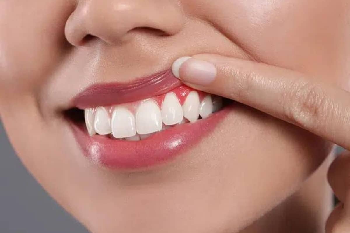 Periodontist Seattle
