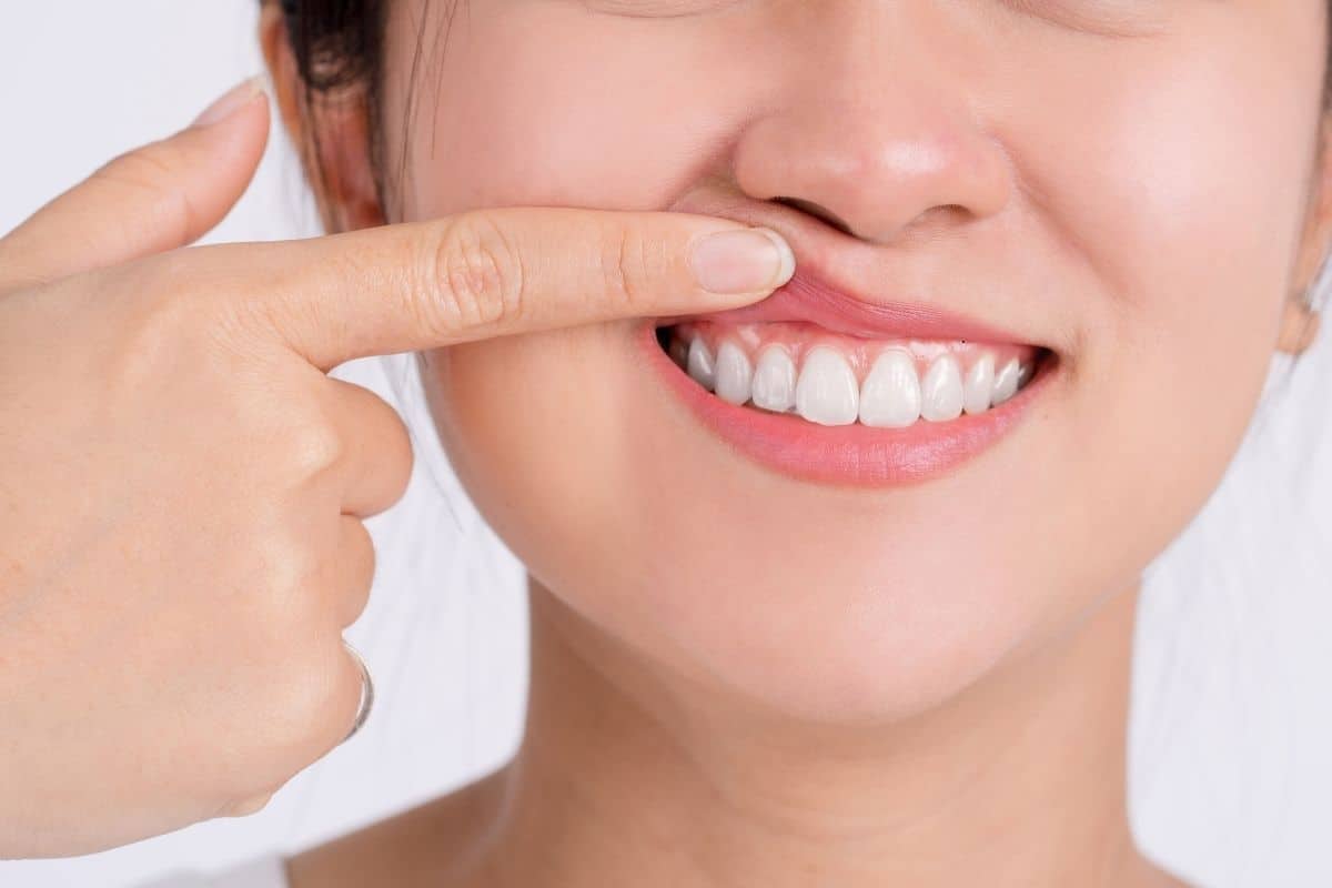 Periodontist Seattle