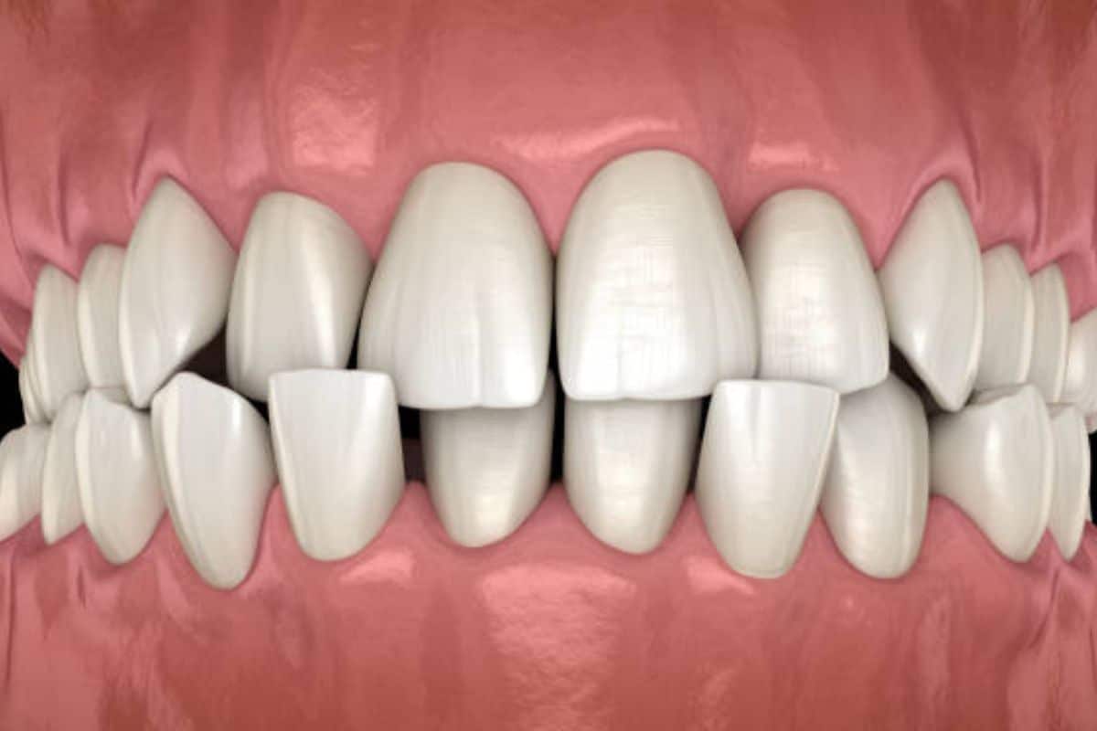 Dentist seattle wa