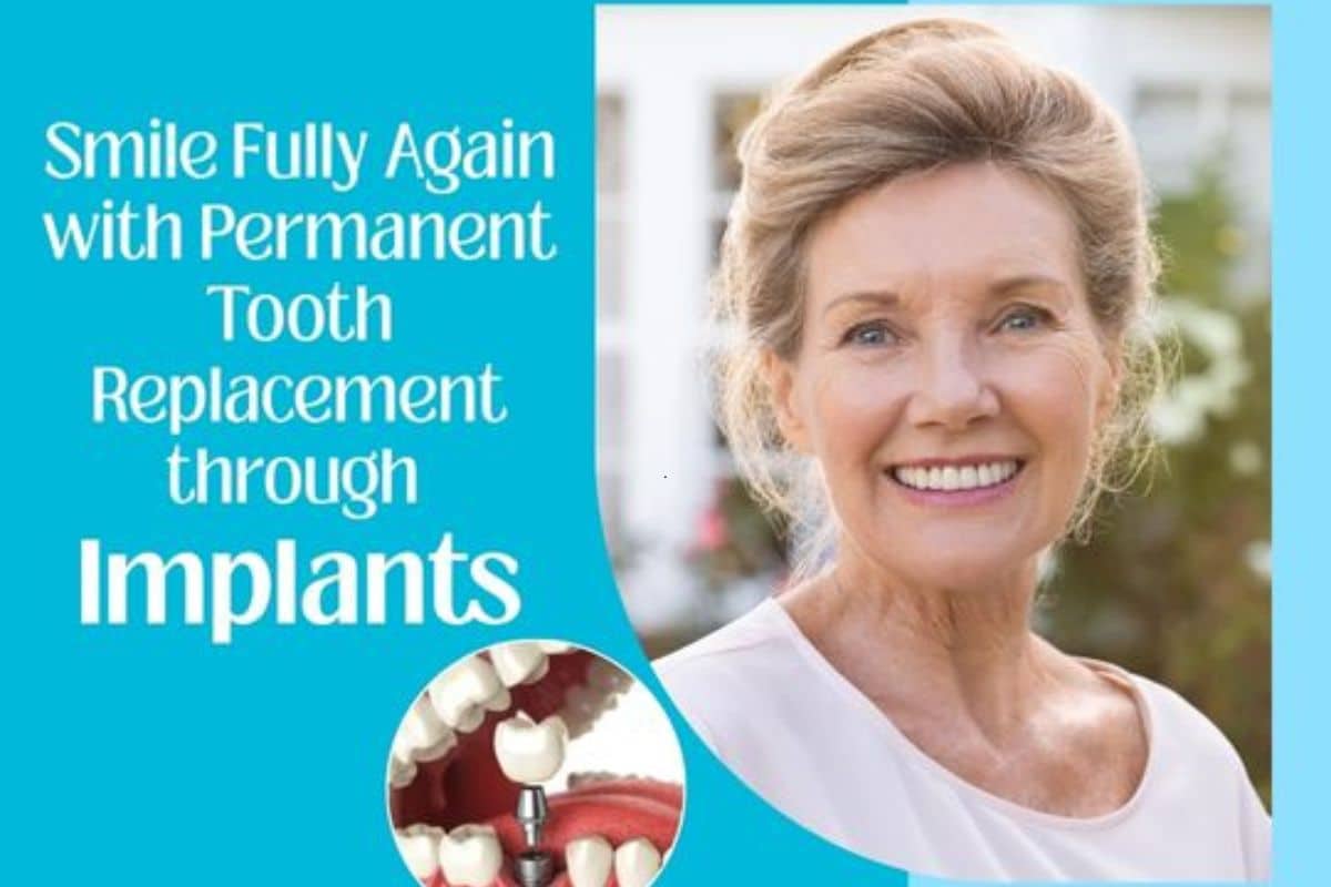 Dental Implants in Seattle