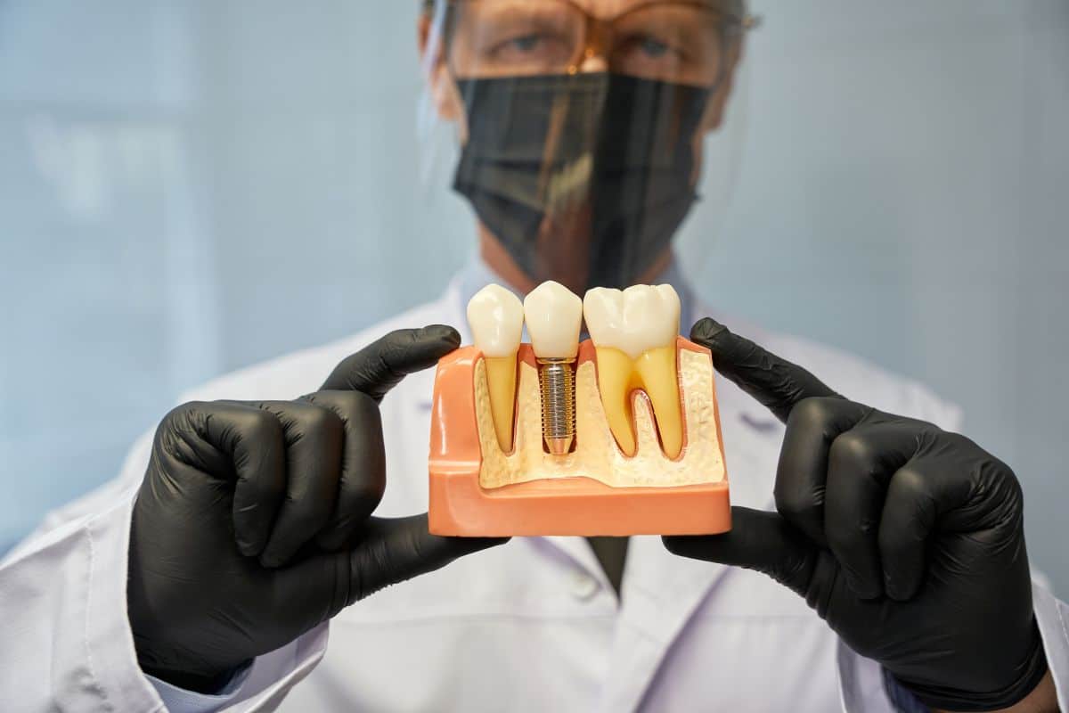dental implants in Seattle