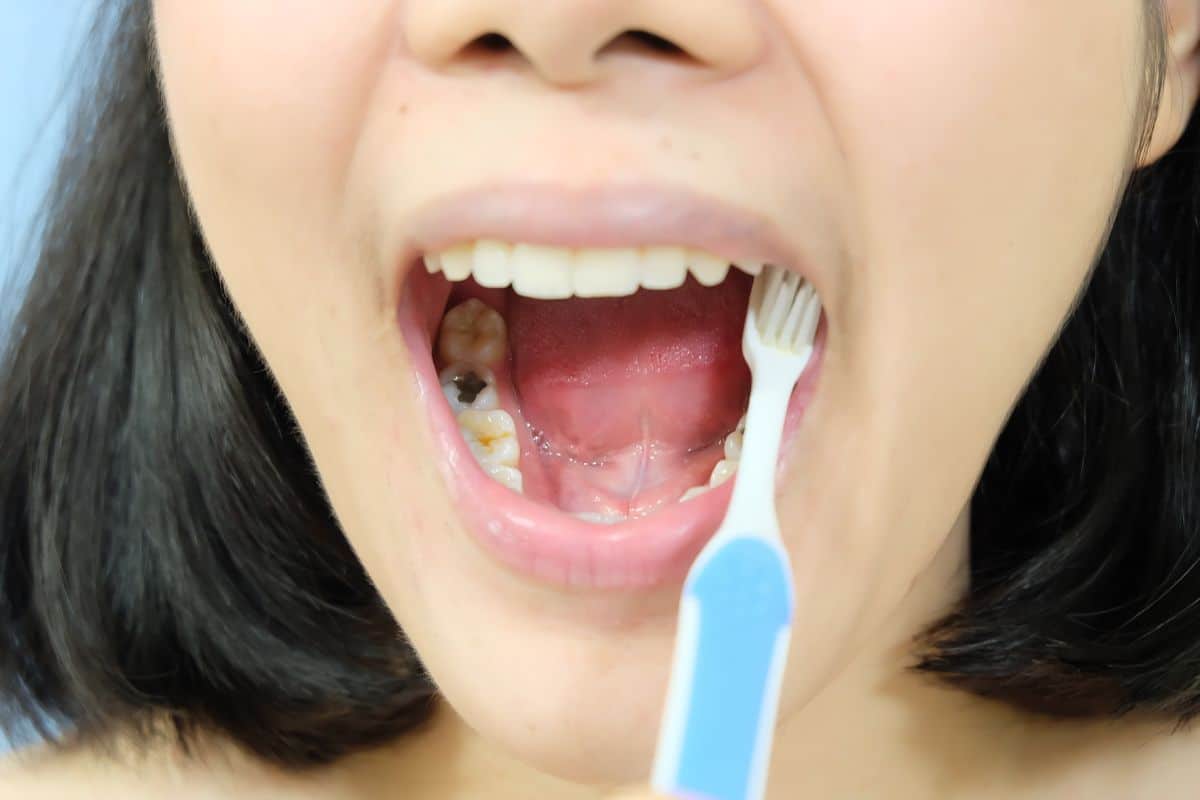 dentist in Seattle play a critical role in preventing silent dental problems