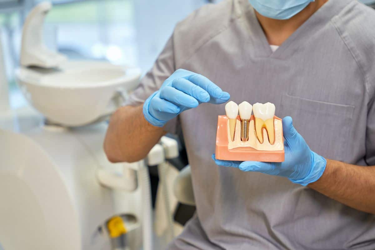 know before getting dental implants in Seattle