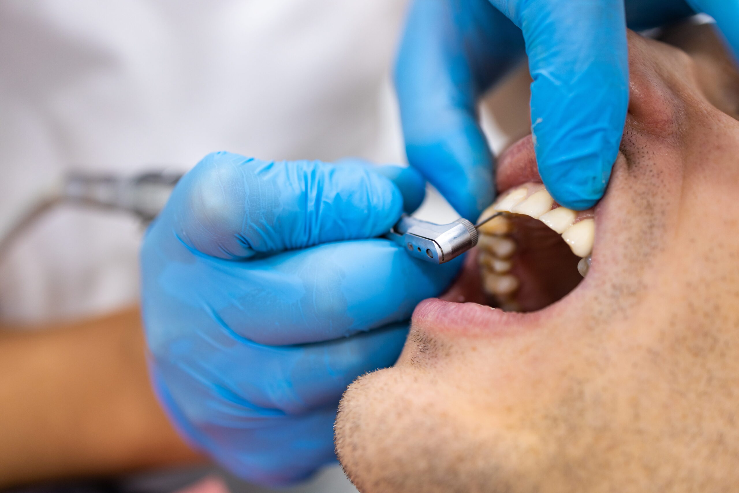 Is Titanium Safe in Your Body Long-Term