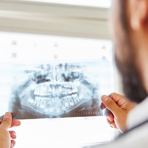 Oral Surgeon Seattle