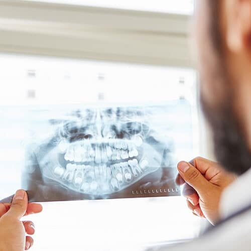 image of a dentist looking at x-rays